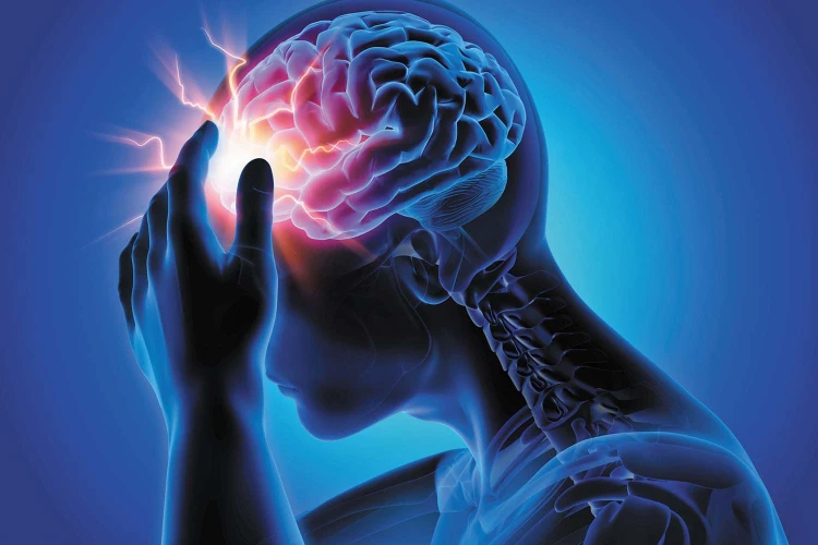 headaches and migraines