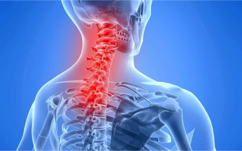neck pain